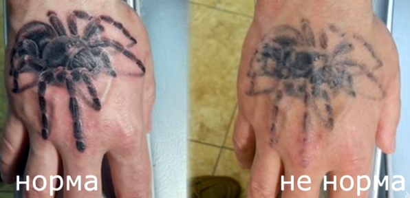 сколько дней заживает татуировка на руке